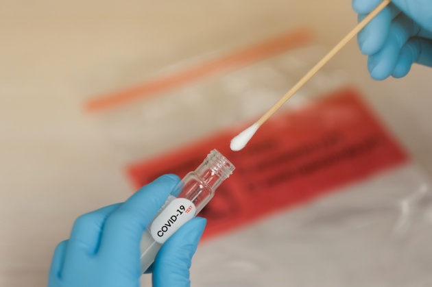 Sierologici e Tamponi a prezzi calmierati